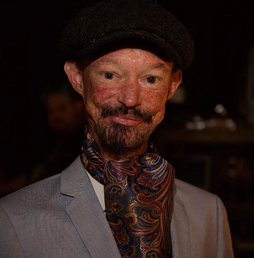 Помер актор культового серіалу "Гра престолів". Даррену Кенту було лише 36 років